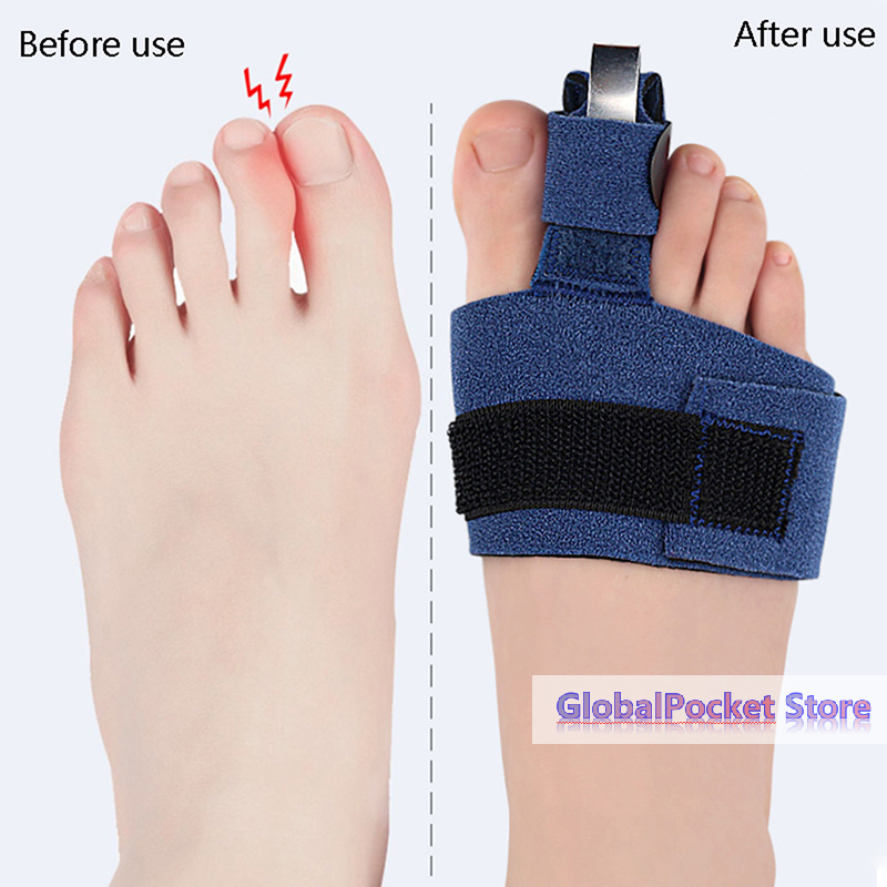 1Pcs Toe Corrector Toe Fractur – обзор и цена Ankle Brace Sock