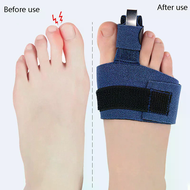 1Pcs Toe Corrector Toe Fractur – обзор и цена Ankle Brace Sock